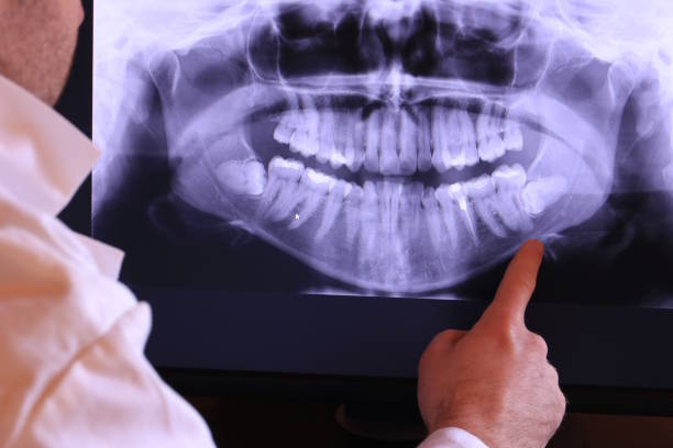 Best Emergency Wisdom Teeth Removal in Seward, AK
