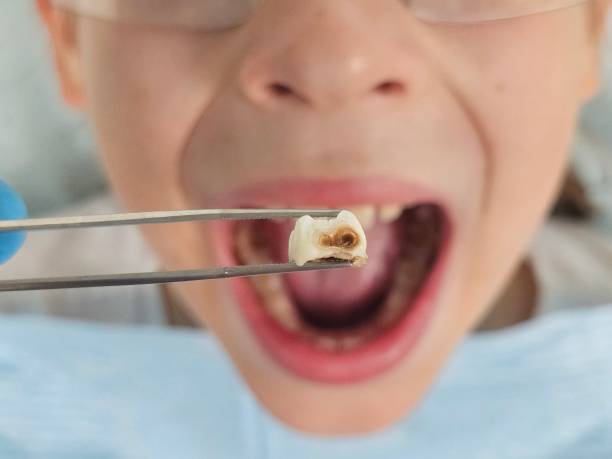 Best Pediatric Emergency Dentist in Seward, AK